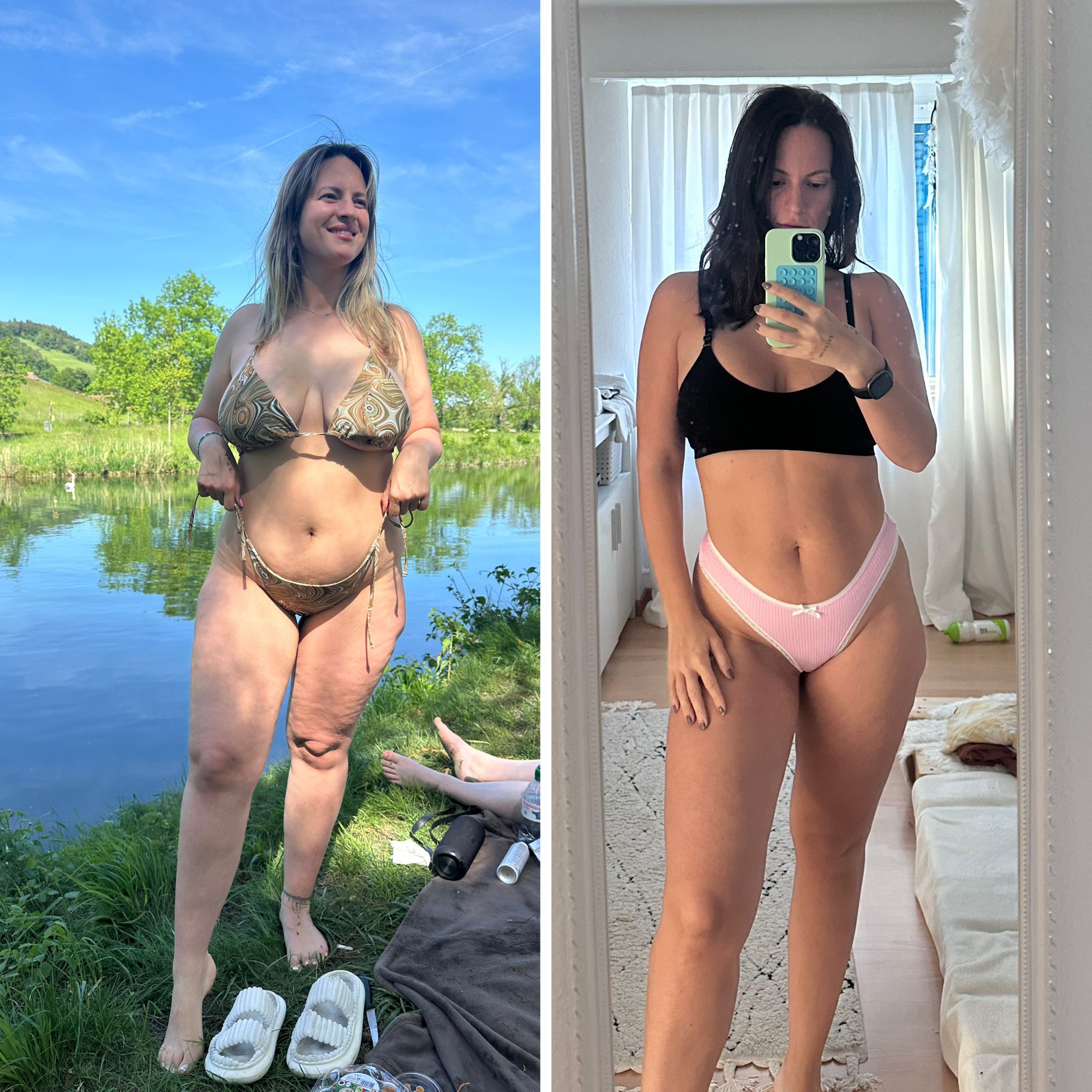 Dona vorher und nachher – 30 kg abgenommen trotz Lipödem